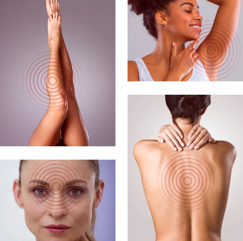 Áreas de Aplicação Adélla Laser