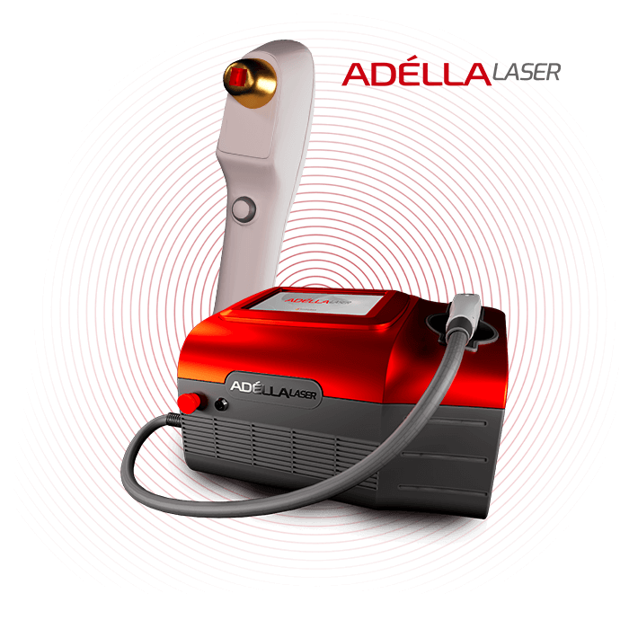 Manopla Adélla Laser